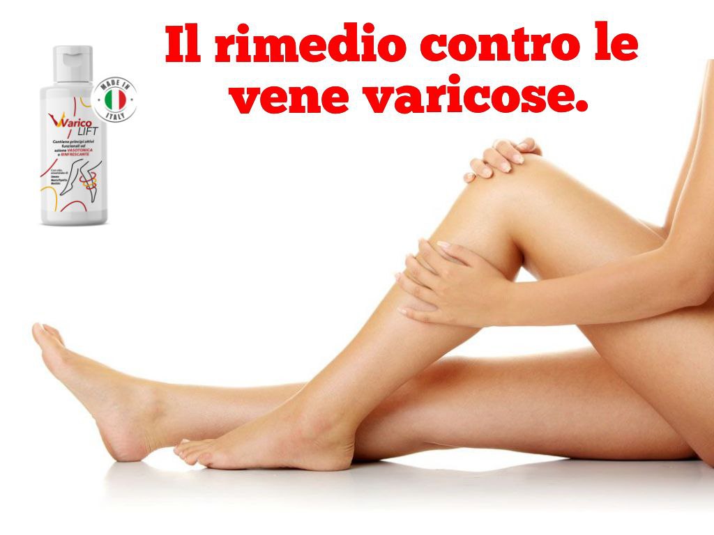 crema naturale per vene varicose